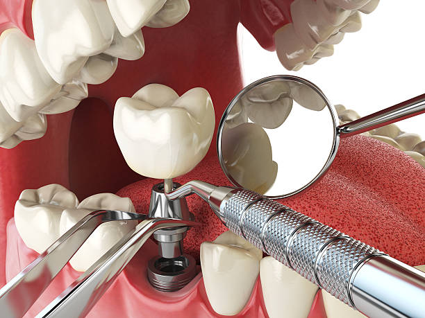 Best Emergency Dental Extractions in South Les, AK
